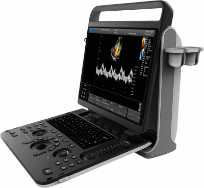 Chison SonoTouch 60