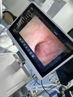 Эндоскопический видеопроцессор обработки изображения INNERMED VES-100