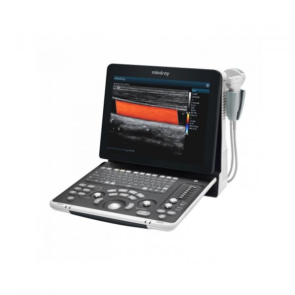 Mindray Z60