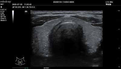 Mindray MX7 