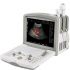 Acuvista RS880i