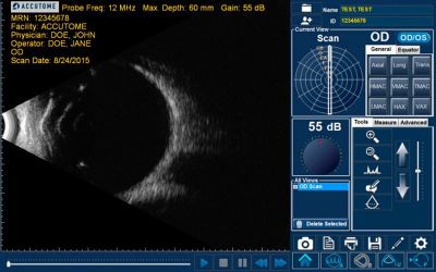 Accutome by Keeler B-scan Plus