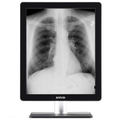 Barco Coronis 5MP LED MDCG-5221