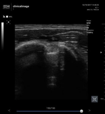 Healcerion Sonon 300C