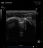 Healcerion Sonon 300C