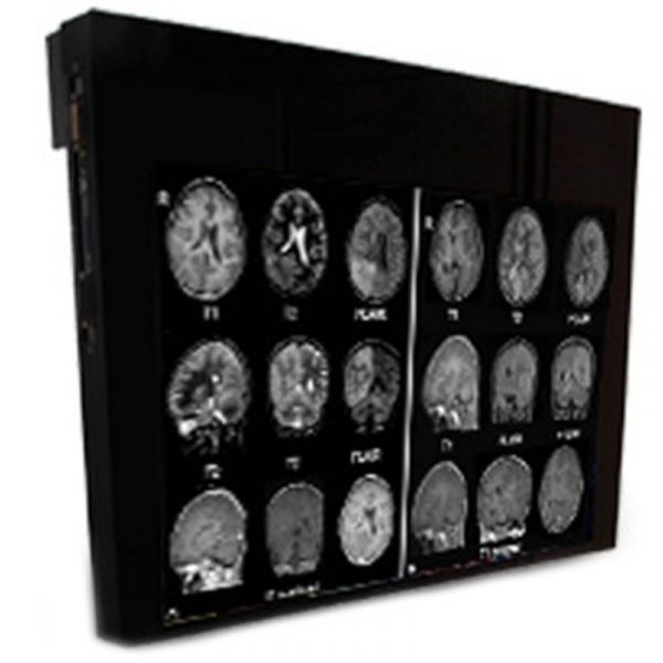 Double Black Imaging 24″ MRSafe Display