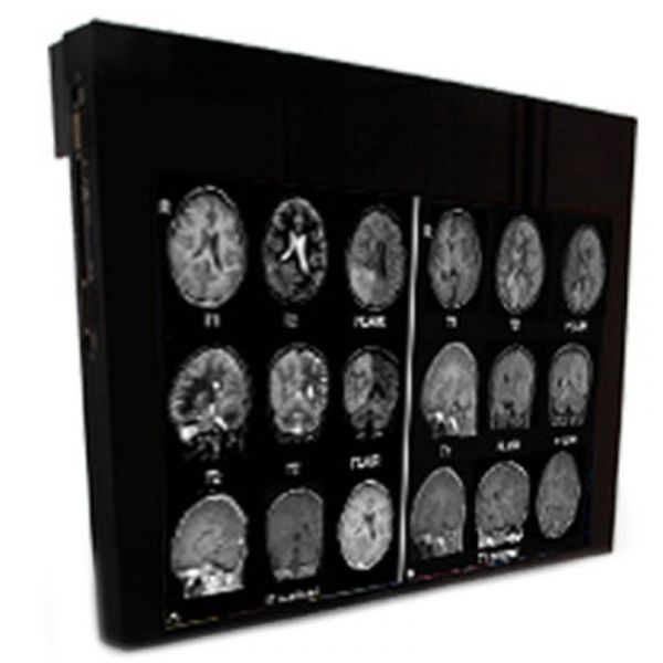Double Black Imaging 32″ MRSafe Display