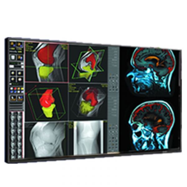 Double Black Imaging 42″ Professional LCD