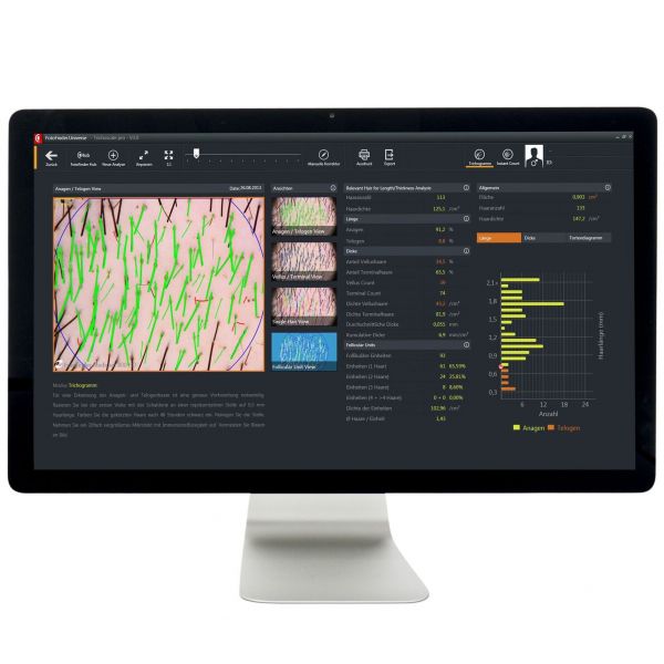 FotoFinder Trichovision