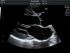 GE Healthcare Voluson P8