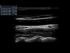 GE Healthcare Vivid S60