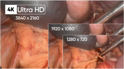 Видеоэндоскопическая камера 4К UHD Shteiman 9211
