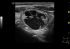 GE Healthcare Logiq P7