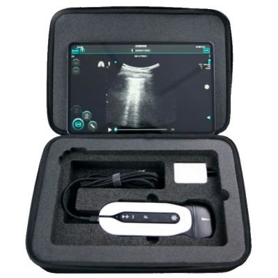 Chison SonoTouch 30 (SonoEye)