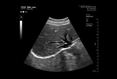 Healcerion Sonon 300C