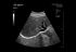 Healcerion Sonon 300C