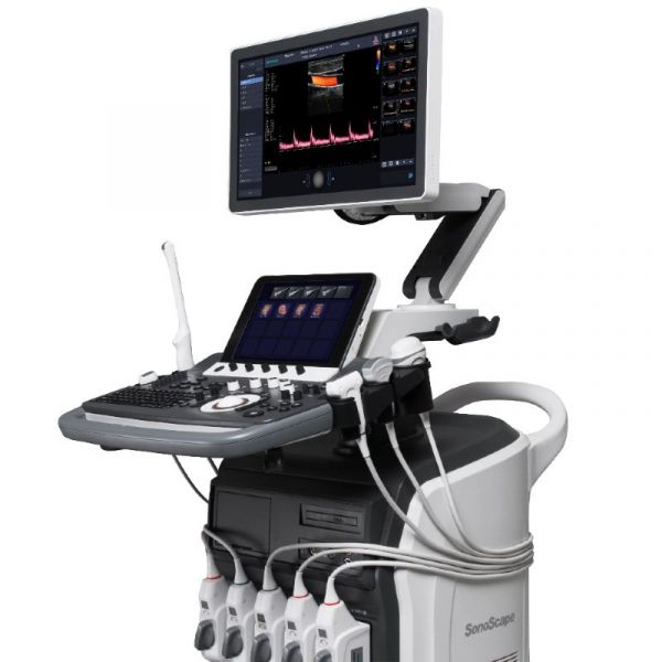 Sonoscape S40