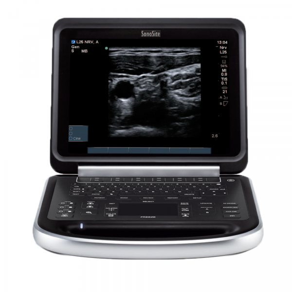 Fujifilm Sonosite Edge