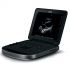 Fujifilm Sonosite Edge II