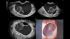 GE Healthcare Voluson E8
