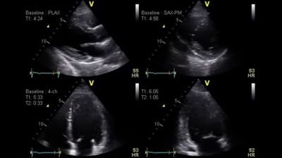 GE Healthcare Vivid T9